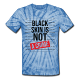 Black Skin is Not A Crime: Unisex Tie Dye T-Shirt - spider baby blue